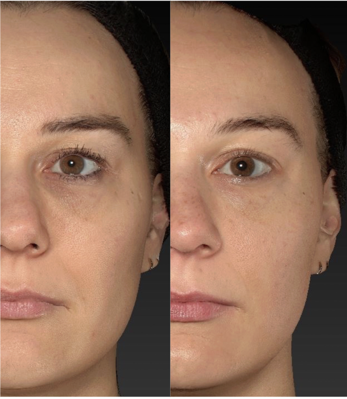 PolyPhil eredmény 1